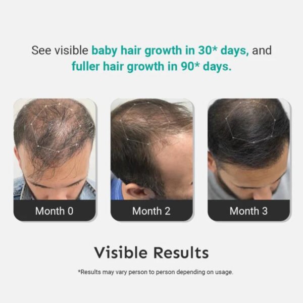 Arata - Intensive Hair Growth Serum 30ml - Image 3