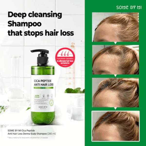 SOME BY MI – Cica Peptide Anti Hair Loss Derma Scalp Shampoo 285ml - Image 5
